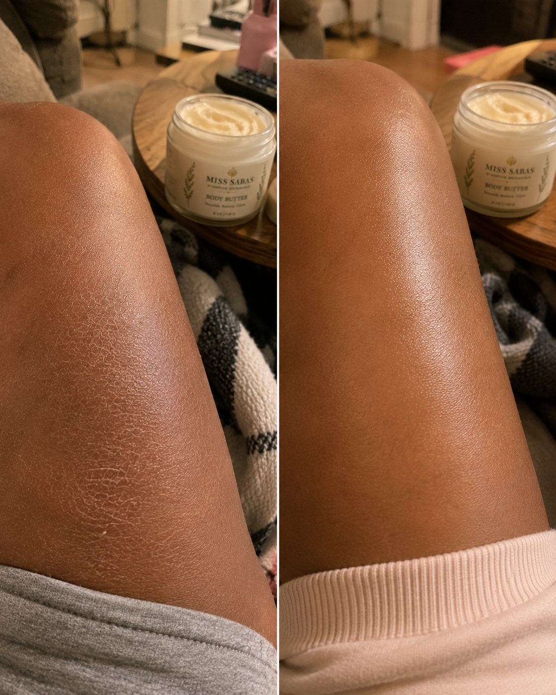 Body Butter results on leg